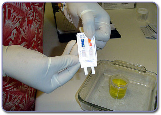 Drug test, una forma di prevenzione precoce