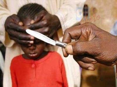 Onu: Tolleranza Zero verso le Mutilazioni Genitali Femminili