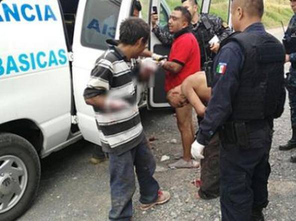 Messico, gang punisce mozzando le mani