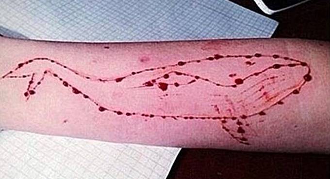 Lesioni sospette su adolescenti, l’ombra di Blue Whale piomba su #Fiumicino