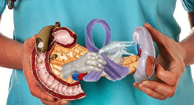Tumore al pancreas, #Cerveteri aderisce all’appello dell’associazione Nastro Viola