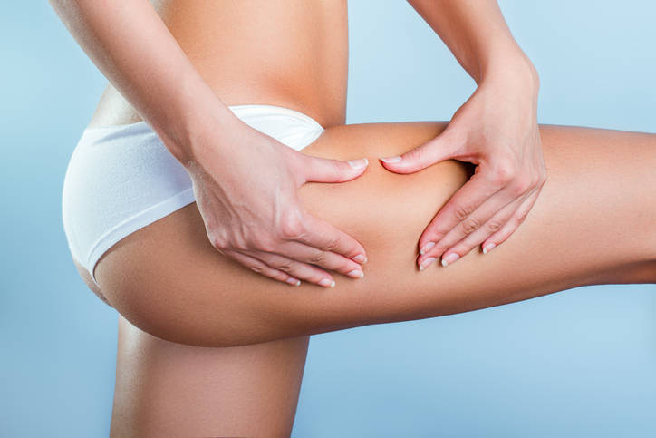 Cellulite, come combatterla con trattamenti specifici