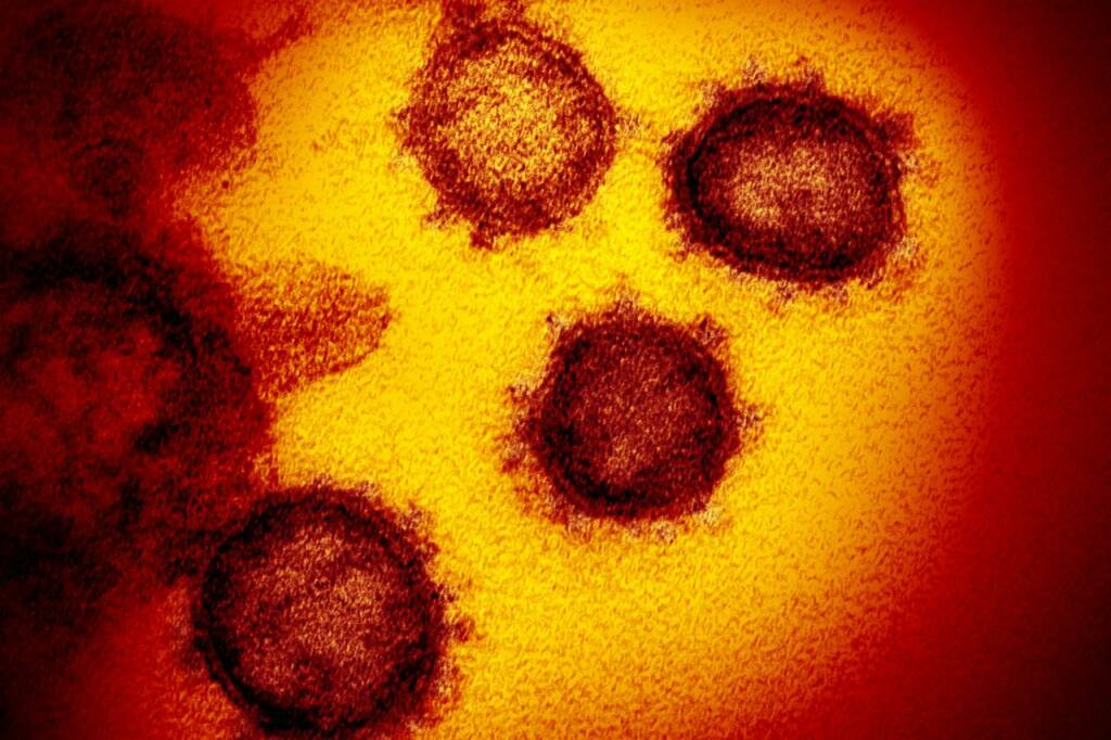 Coronavirus, dall’Australia un vaccino che ha superato i test di laboratorio