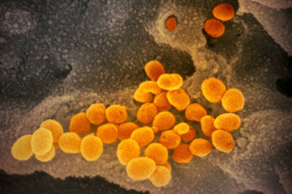 Dagli Usa il primo ritratto del Coronavirus cinese in cinque foto a colori
