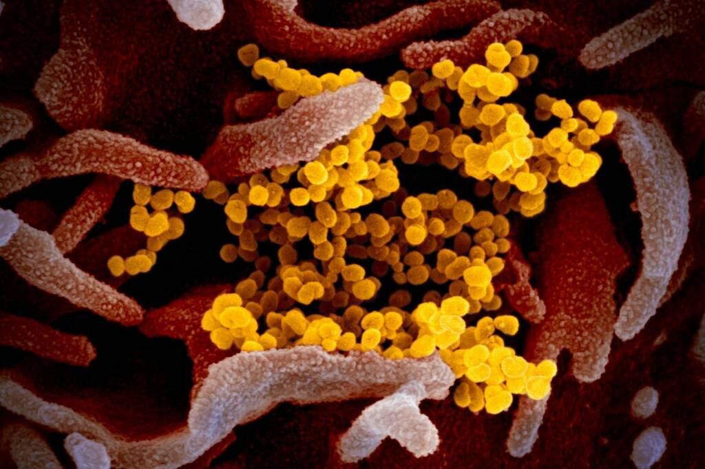 Coronavirus, uno studio rivela chi è più a rischio