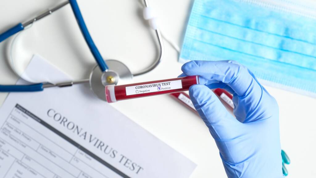 Coronavirus, Regione Lazio: approvata la delibera per i test sierologici agli operatori sanitari e forze dell’ordine”