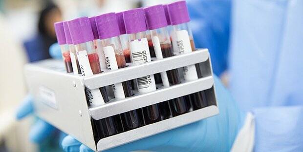 Coronavirus, in Francia test sierologici rapidi anche in farmacia
