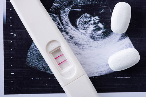 Aborto e contraccezione, Ass. Coscioni e Amica: “Garantire servizi previsti dalla legge 194”