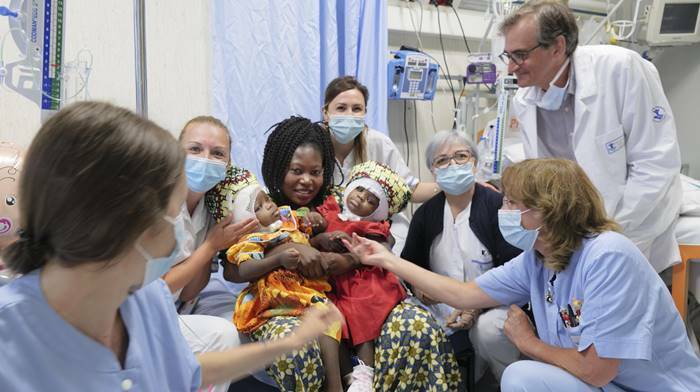 Operazione senza precedenti: gemelline siamesi unite per la nuca divise al Bambin Gesù