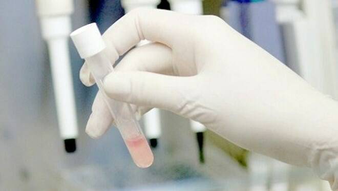 Arrivano i test di prevenzione per i tumori del colon retto nelle Farmacie Comunali di Fiumicino