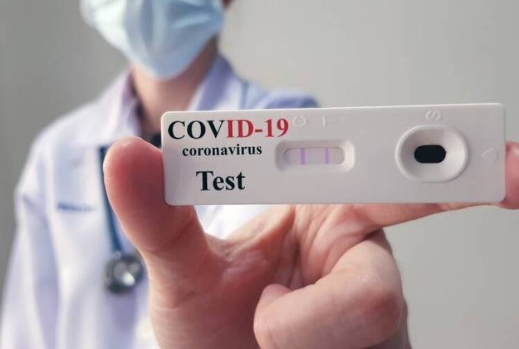 Coronavirus, Unità Crisi Lazio: “Si ai test antigenici, no ai test molecolari non validati dallo Spallanzani”