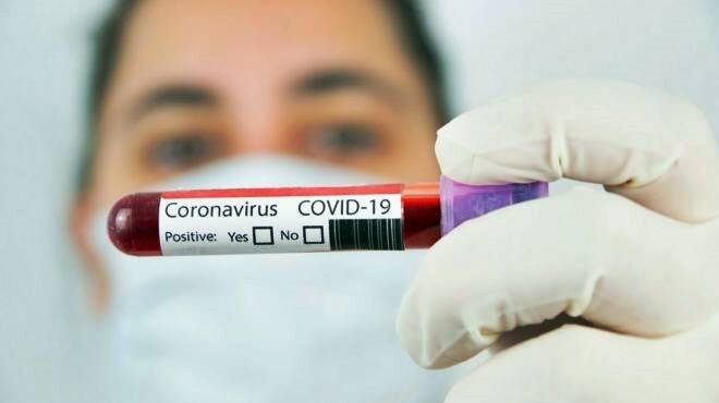 Covid-19, nel Lazio 2407 nuovi casi positivi ma calano i ricoveri in terapia intensiva