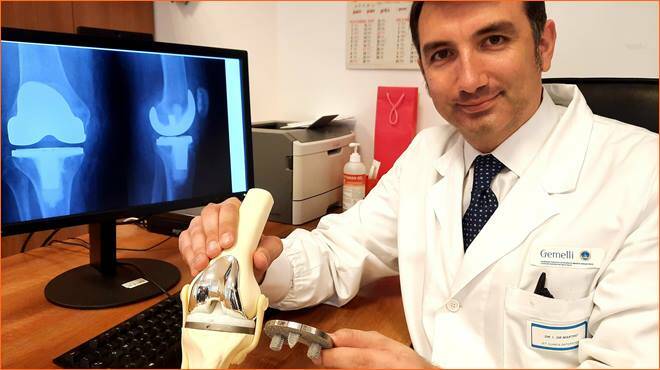 Policlinico Gemelli, impiantata la prima protesi del ginocchio in titanio prodotta con una stampante 3D